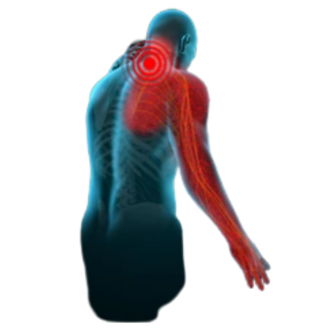 numbness in hands .A person's arm with a tingling sensation, causing a pins and needles feeling.
