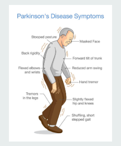 parkinson's disease. Cura Advanced Physiotherapy 