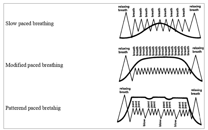 Breathing Exercise in Pregnancy