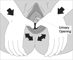 perineal massage in labor pain 