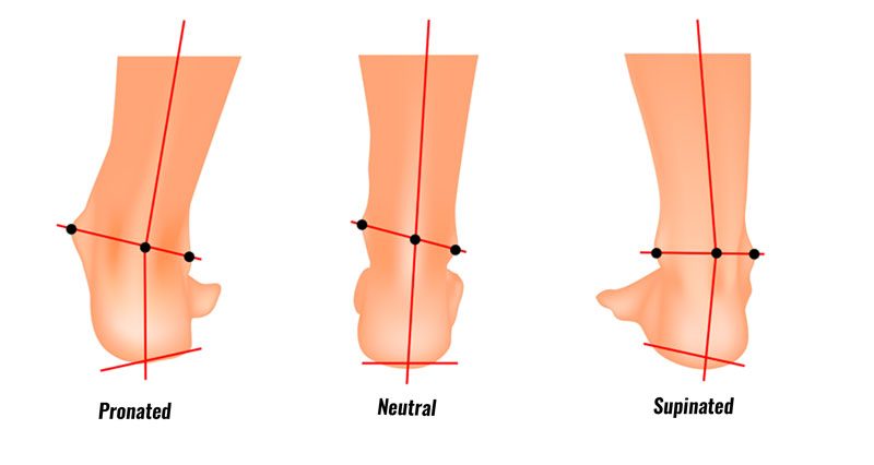 Pain in front of leg physiotherapy