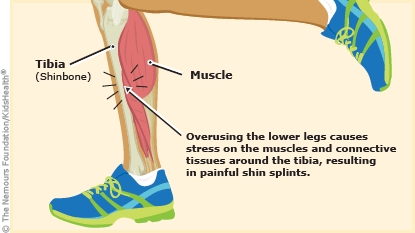 Pain in front of leg