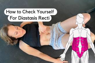 how to check diastasis recti